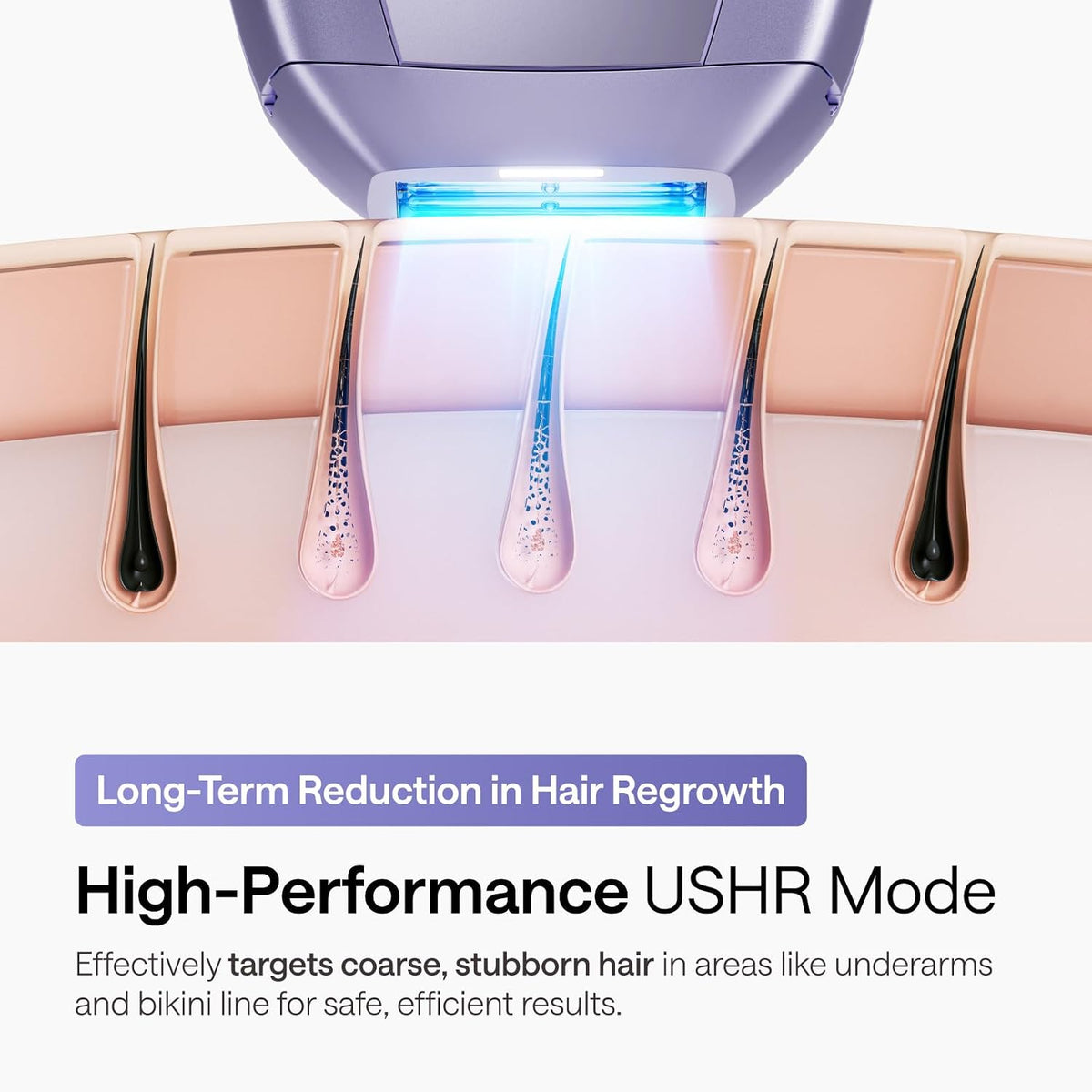 Ulike IPL Hair Removal Device Air 10 Deluxe, Laser Hair Removal Device for Women and Men Pain-Free Ice Cooling and Permanent Hair Reduction, Skin Sensor & USHR Mode* for Full Body Treatment
