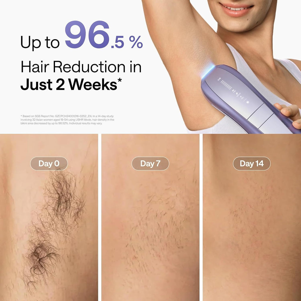 Ulike IPL Hair Removal Device Air 10 Deluxe, Laser Hair Removal Device for Women and Men Pain-Free Ice Cooling and Permanent Hair Reduction, Skin Sensor & USHR Mode* for Full Body Treatment