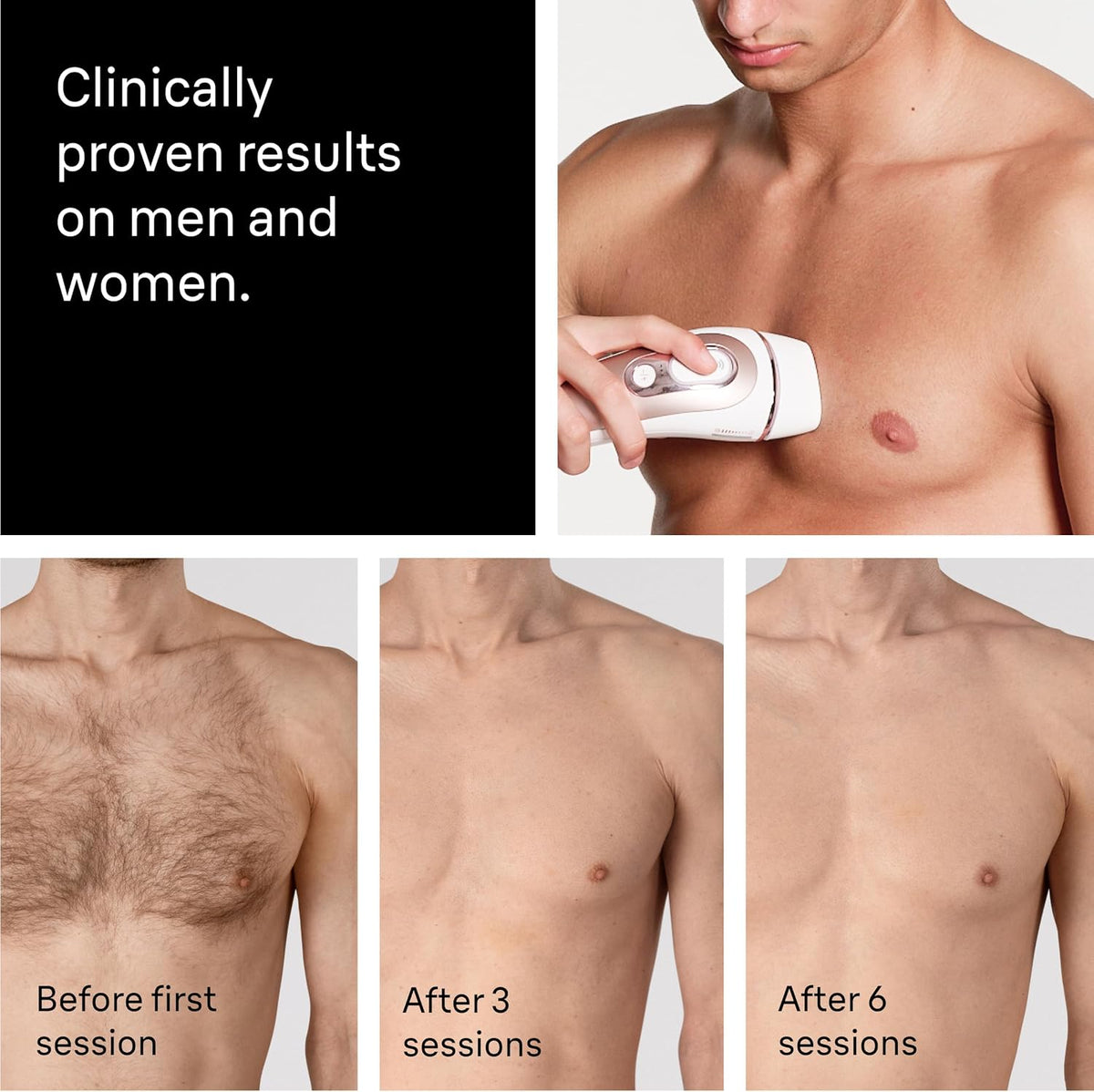 Braun Smart IPL Laser Hair Removal Device for Women, Skin i·Expert, PL7442